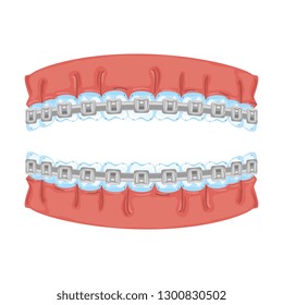 human teeth with orthodontics