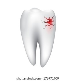 human tooth with caries isolated on a white background 