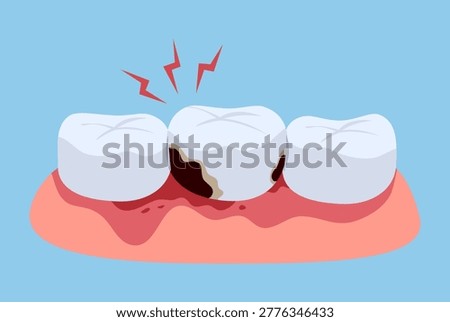 Human tooth decay with cavity and dental caries illustration