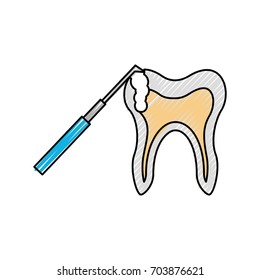 Human tooth with dental drill