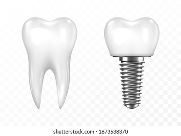 Human tooth and Dental implant on transparent background