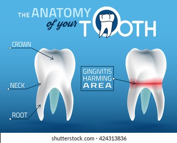 Human tooth dental infographic. Editable vector illustration. Medical image in white, pink and dark blue colors on a light blue background useful for poster, leaflet or brochure graphic design.