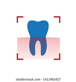 Human Tooth Scanning. Red Scanner Or Xray. Dental Implant. Treatment Scan Concept. Vector Illustration Isolated On White Background.