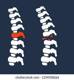 Human white ridge. Red bone. Back pain. Fracture of the spine. backache and medical care. X-ray of the spinal column. Trauma to the internal organ and intervertebral disc. Cartoon flat illustration