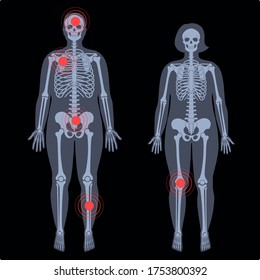 Human woman and man skeleton pain, fracture or inflammation in front on x ray view. Vector isolated flat illustration of skull and bones in female and male body.