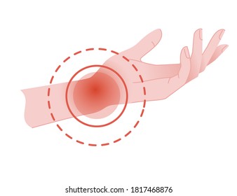 Human wrist pain with red pain circle flat vector illustration on white background