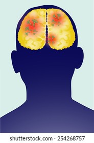 Humans have fungus in the brain.