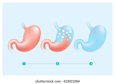  Human's Stomach And Digestive.  Vector Illustration