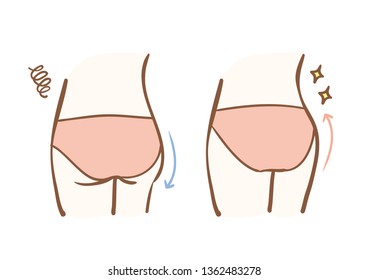 Hung hips and tight hips
