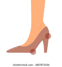 Hurt area of foot because of wearing high heels. Foot and ankle pain, blister and suffering. Bones, muscles and ankles damage. Flat vector illustration.