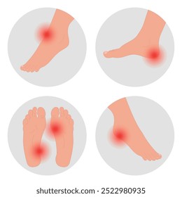 Hurt, pain feet in different location. Foot pain disease 