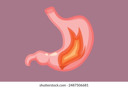 
Dolor de estómago en el fuego Vector ilustración de dibujos animados. Dolor de estómago con problemas gastrointestinales 
