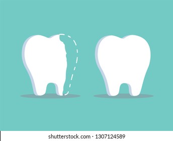 Hurt tooth, restoration of damaged teeth, toothache