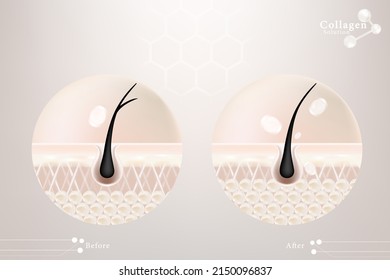 Hyaluronic acid before and after hair and skin solutions ad, white collagen serum drop over skin cells with cosmetic advertising background ready to use, illustration vector.