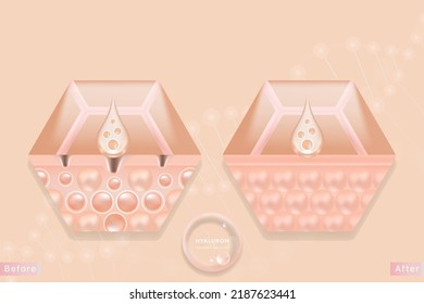 Hyaluronic acid before and after hair and skin solutions ad, pink collagen serum drop into skin cells with cosmetic advertising background ready to use, illustration vector.	