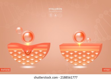 Hyaluronic acid before and after hair and skin solutions ad. red collagen serum drop over skin cells with cosmetic advertising background ready to use, illustration vector.	