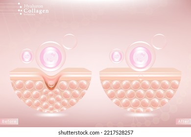 Hyaluronic acid before and after hair and skin solutions ad. pink collagen serum drop into skin cells with cosmetic advertising background ready to use, illustration vector.	