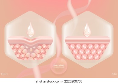 Hyaluronic acid before and after hair and skin solutions ad. pink collagen serum drop into skin cells with cosmetic advertising background ready to use, illustration vector.	