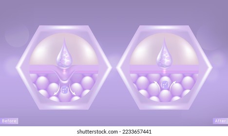 Hyaluronic acid before and after hair and skin solutions ad. purple collagen serum drop into skin cells with cosmetic advertising background ready to use, illustration vector.	