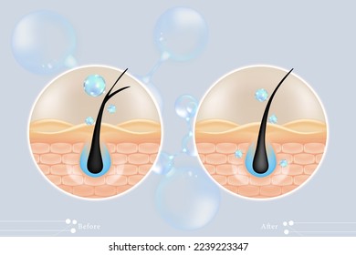 Hyaluronsäure vor und nach Haar- und Hautlösungen und blaues Kollagen-Serum fällt in Hautzellen mit kosmetischen, gebrauchsfertigen Werbetafeln, Vektorgrafik.	