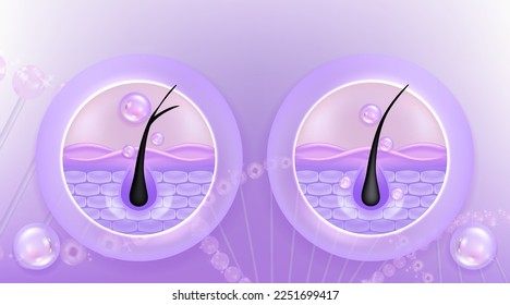 Hyaluronic acid before and after hair and skin solutions ad, purple collagen serum drop over skin cells with cosmetic advertising background ready to use, illustration vector.	