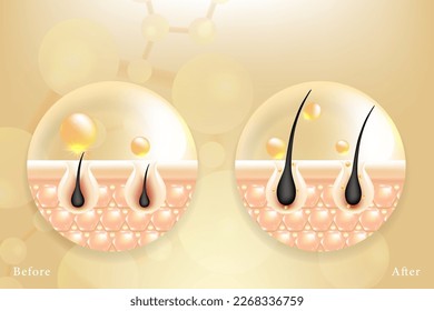 Hyaluronic acid before and after hair and skin solutions ad. gold collagen serum drop into skin cells with cosmetic advertising background ready to use, illustration vector.	