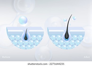 Hyaluronic acid before and after hair and skin solutions ad. blue collagen serum drop into skin cells with cosmetic advertising background ready to use, illustration vector.	