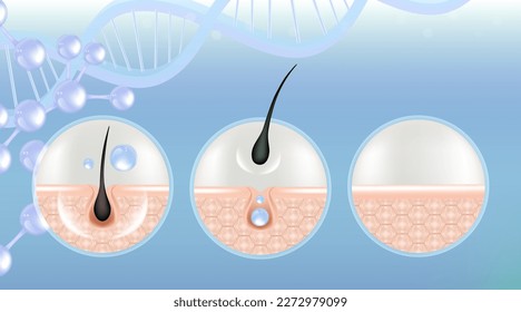 Hyaluronic acid before and after hair and skin solutions ad, blue removing serum drop over skin cells with cosmetic advertising background ready to use, illustration vector.	
