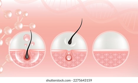 Hyaluronic acid before and after hair and skin solutions ad, pink removing serum drop over skin cells with cosmetic advertising background ready to use, illustration vector.	