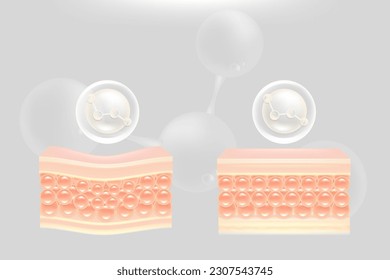 Ácido hialurónico antes y después de soluciones para el cabello y la piel y, suero de colágeno blanco cae en células de la piel con fondo publicitario estético listo para usar, vector ilustrativo.	