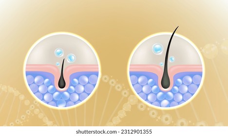 Hyaluronic acid before and after hair and skin solutions ad. blue collagen serum drop into skin cells with cosmetic advertising background ready to use, illustration vector.	