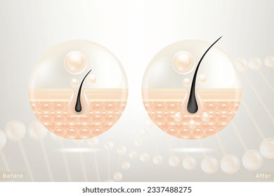 Hyaluronic acid before and after hair and skin solutions ad. white collagen serum drop into skin cells with cosmetic advertising background ready to use, illustration vector.