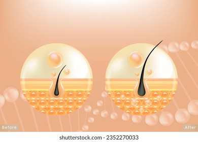 Hyaluronic acid before and after hair and skin solutions ad. gold collagen serum drop into skin cells with cosmetic advertising background ready to use, illustration vector.