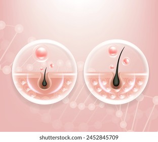 Hyaluronic acid before and after hair and skin solutions ad. pink collagen serum drop into skin cells with cosmetic advertising background ready to use, illustration vector.