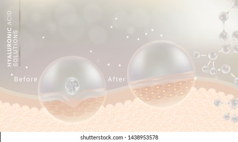 Hyaluronic acid before and after skin solutions ad, white collagen serum drop with cosmetic advertising background ready to use, illustration vector.