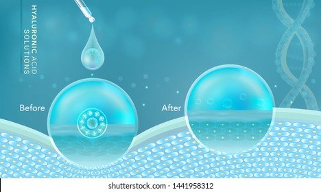 Hyaluronic acid before and after skin solutions ad, blue collagen serum drop with cosmetic advertising background ready to use, illustration vector.	
