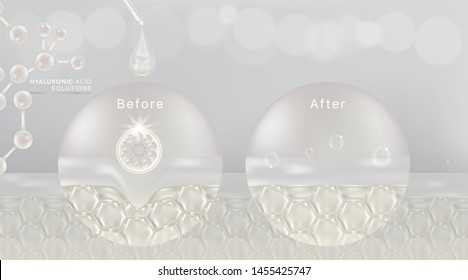 Hyaluronic acid before and after skin solutions ad, white collagen serum drop with cosmetic advertising background ready to use, illustration vector.	