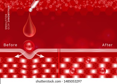 Hyaluronic acid before and after skin solutions ad, red collagen serum drop with cosmetic advertising background ready to use, illustration vector.	