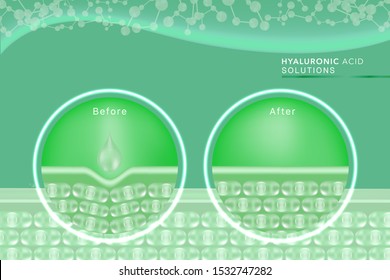 Hyaluronic acid before and after skin solutions ad, green collagen serum drop with cosmetic advertising background ready to use, illustration vector.	