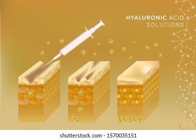 Hyaluronic acid before and after skin solutions ad, gold collagen serum drop with cosmetic advertising background ready to use, illustration vector.	