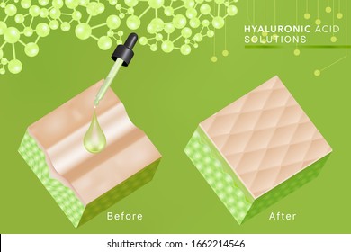 Hyaluronic acid before and after skin solutions ad, green collagen serum drop with cosmetic advertising background ready to use, illustration vector.	