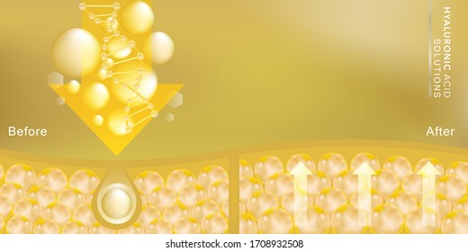Hyaluronic acid before and after skin solutions ad, gold collagen serum drop with cosmetic advertising background ready to use, illustration vector.	