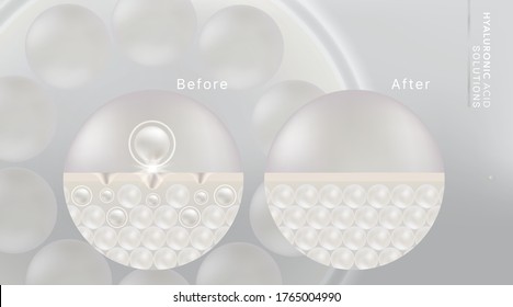 Hyaluronic acid before and after skin solutions ad, white collagen serum drop with cosmetic advertising background ready to use, illustration vector.	