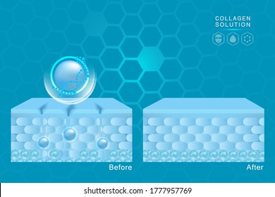 Hyaluronic acid before and after skin solutions ad, blue collagen serum drop with cosmetic advertising background ready to use, illustration vector.	