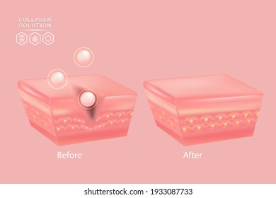 Hyaluronic acid before and after skin solutions ad, pink collagen serum drop with cosmetic advertising background ready to use, illustration vector.