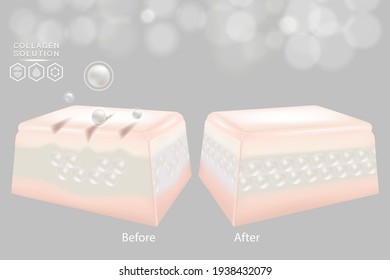 Hyaluronic acid before and after skin solutions ad, white collagen serum drops with cosmetic advertising background ready to use, illustration vector.	