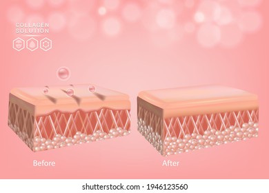 Hyaluronic acid before and after skin solutions ad, pink collagen serum drop with cosmetic advertising background ready to use, illustration vector.