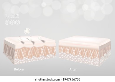Hyaluronic acid before and after skin solutions ad, white collagen serum drop with cosmetic advertising background ready to use, illustration vector.