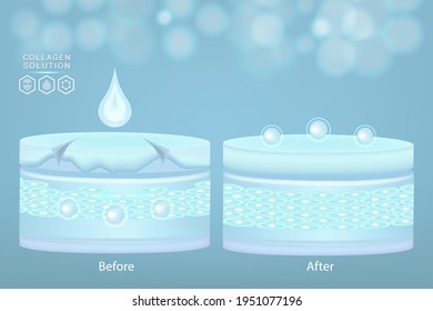 Hyaluronic acid before and after skin solutions ad, blue collagen serum drops with cosmetic advertising background ready to use, illustration vector.