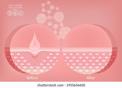 Hyaluronic acid before and after skin solutions ad, pink collagen serum drops with cosmetic advertising background ready to use, illustration vector.